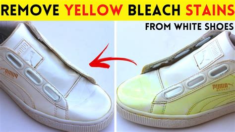 how to clean white shoes that turned yellow|bleached white shoes turned yellow.